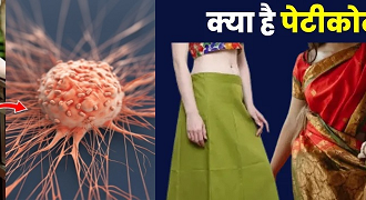 पेटीकोट कैंसर